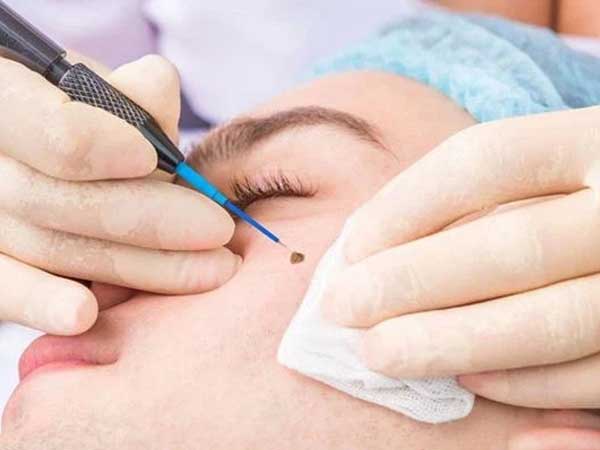 Ảnh bìa bài viết 751376