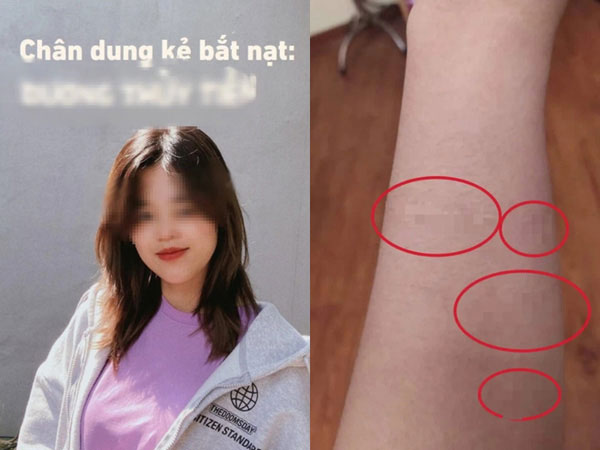 Ảnh bìa bài viết 751739