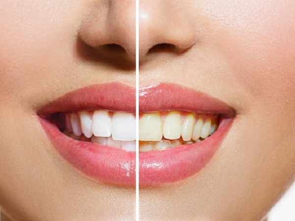 Ảnh bìa bài viết 754346