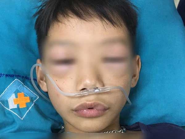 Ảnh bìa bài viết 757632