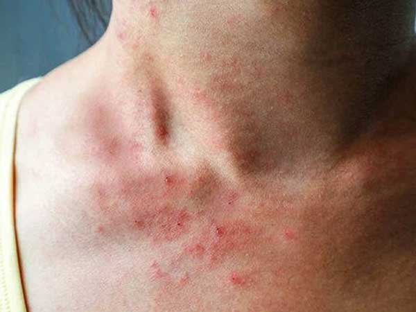 Ảnh bìa bài viết 761081