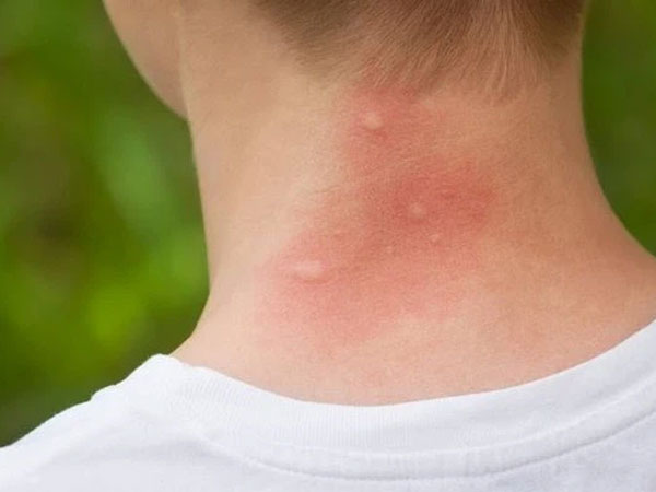 Ảnh bìa bài viết 769185