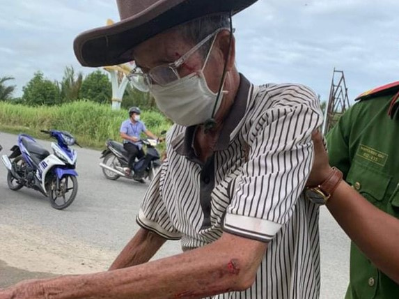 Ảnh bìa bài viết 777918