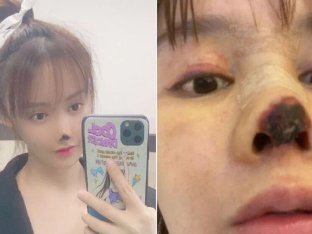 Ảnh bìa bài viết 785783