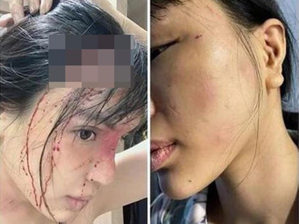 Ảnh bìa bài viết 799558