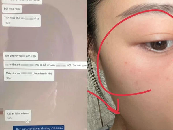 Ảnh bìa bài viết 802944