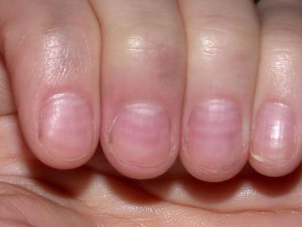 Ảnh bìa bài viết 805342