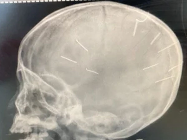 Ảnh bìa bài viết 809757