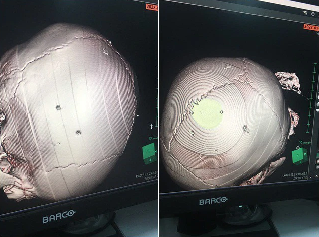 Ảnh bìa bài viết 813765