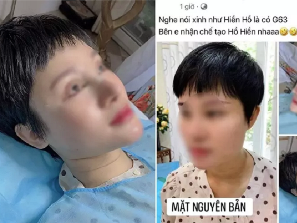 Ảnh bìa bài viết 815491