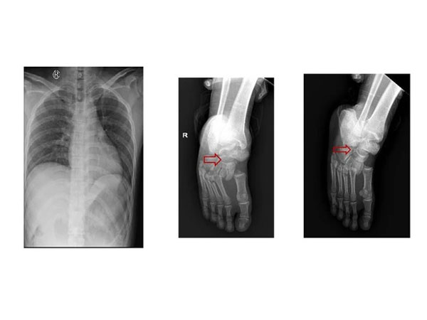 Ảnh bìa bài viết 821246