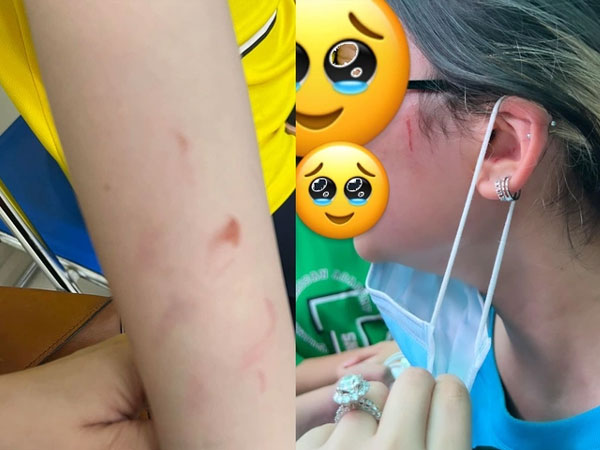 Ảnh bìa bài viết 825384