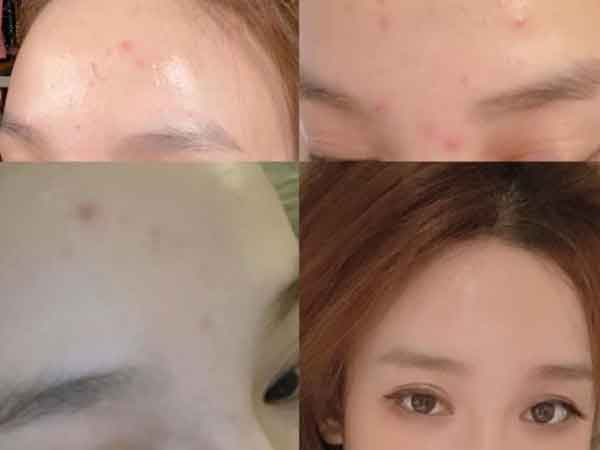 Ảnh bìa bài viết 826326