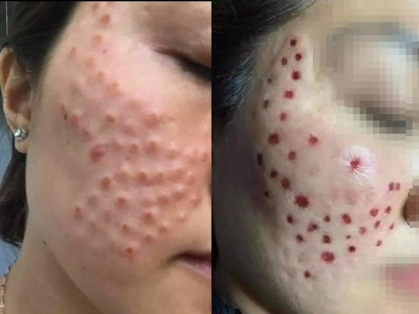 Ảnh bìa bài viết 834258