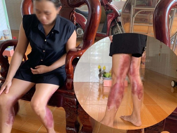 Ảnh bìa bài viết 834341