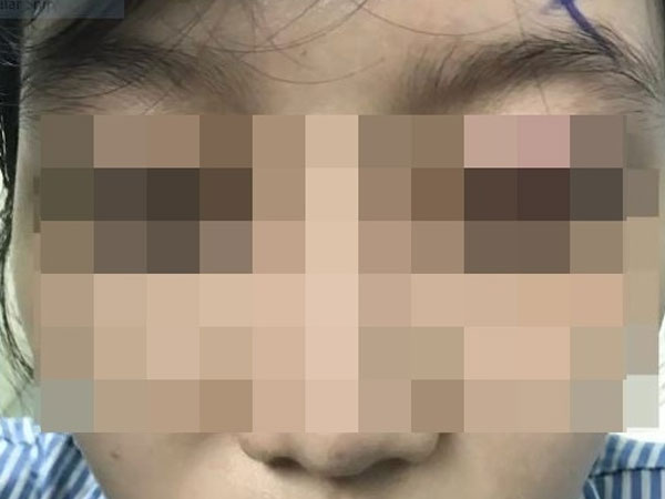 Ảnh bìa bài viết 835259