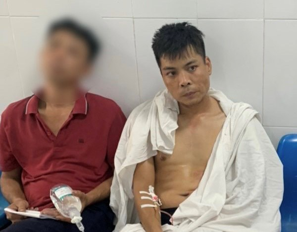 Ảnh bìa bài viết 836621