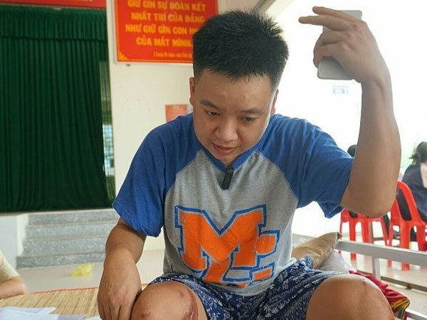 Ảnh bìa bài viết 837710