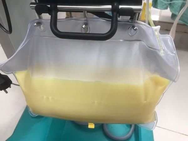 Ảnh bìa bài viết 844415