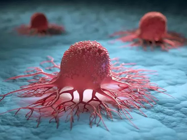 Ảnh bìa bài viết 848957