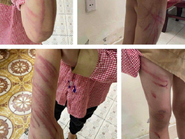 Ảnh bìa bài viết 849577