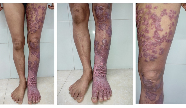 Ảnh bìa bài viết 857227