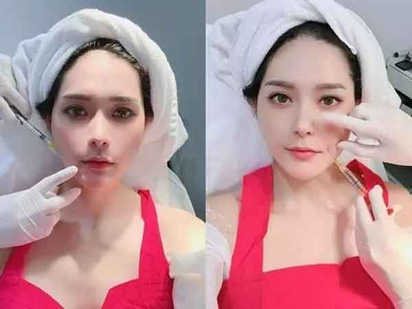 Ảnh bìa bài viết 859761