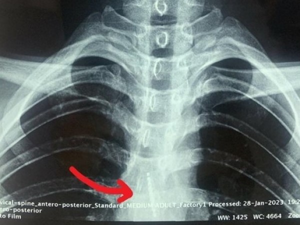 Ảnh bìa bài viết 864551