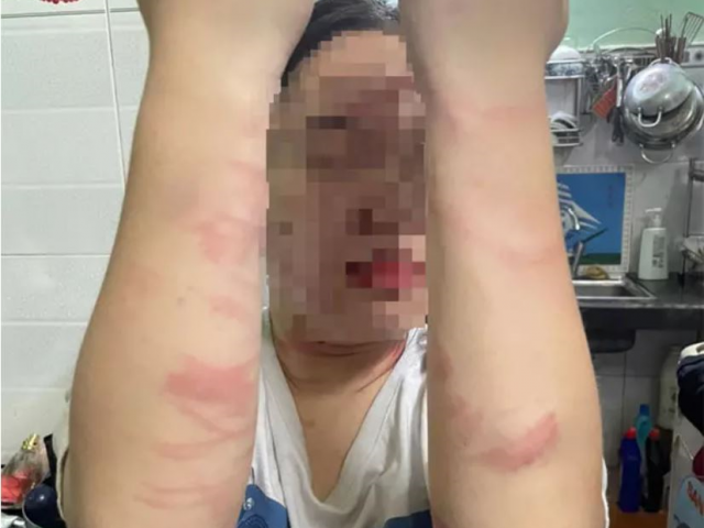 Ảnh bìa bài viết 865177