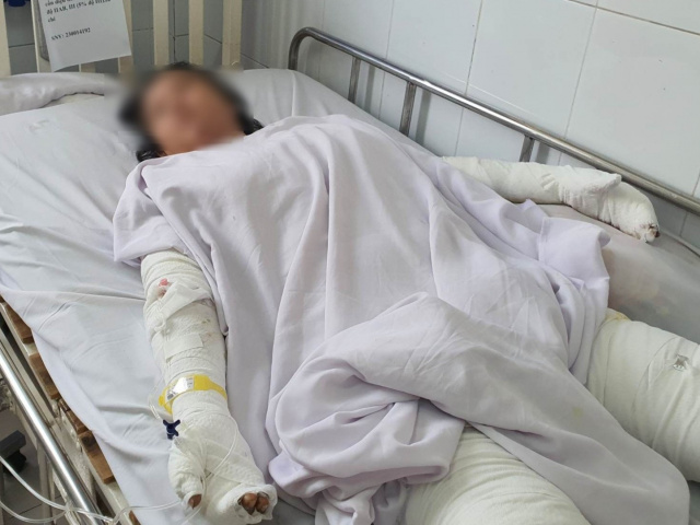 Ảnh bìa bài viết 865658