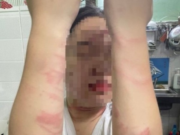 Ảnh bìa bài viết 865950