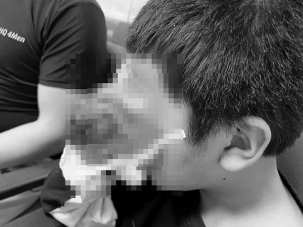 Ảnh bìa bài viết 868761