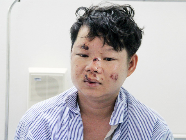 Ảnh bìa bài viết 872098