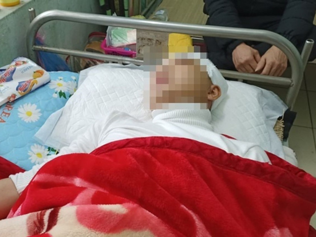 Ảnh bìa bài viết 873168