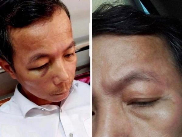 Ảnh bìa bài viết 875506
