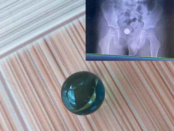 Ảnh bìa bài viết 877491
