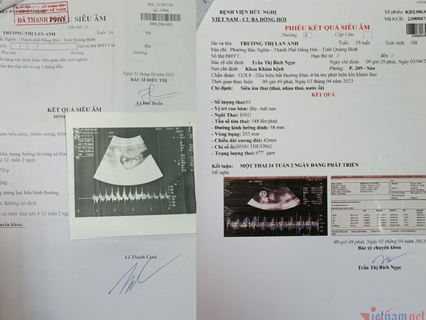Ảnh bìa bài viết 878619