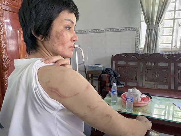 Ảnh bìa bài viết 879117