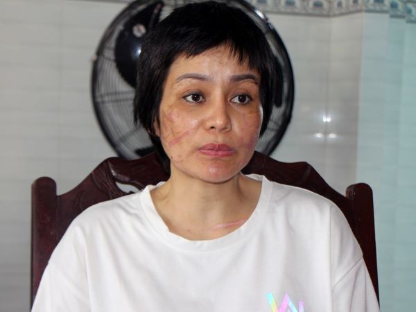 Ảnh bìa bài viết 879609