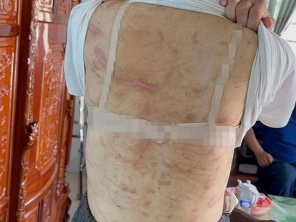 Ảnh bìa bài viết 880018