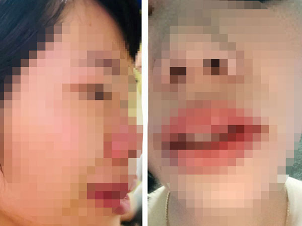 Ảnh bìa bài viết 881712