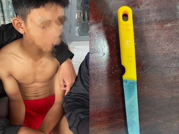 Ảnh bìa bài viết 883497