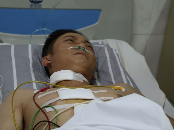 Ảnh bìa bài viết 883640