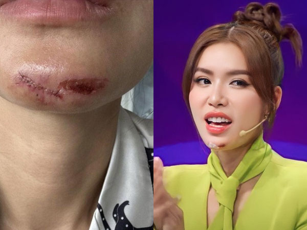 Ảnh bìa bài viết 884523