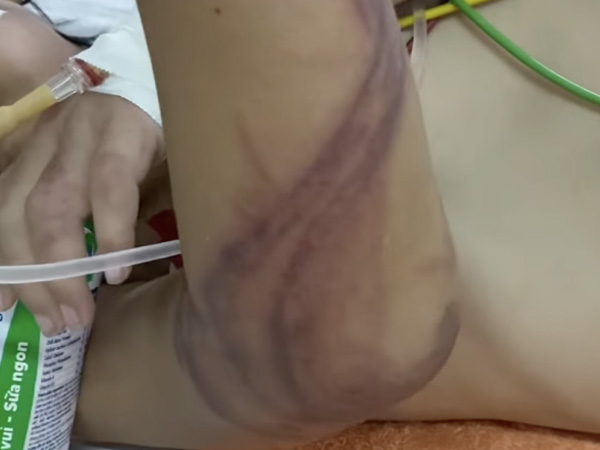 Ảnh bìa bài viết 885389