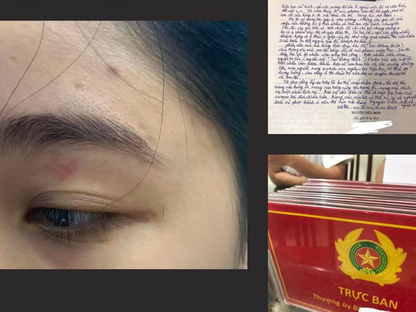 Ảnh bìa bài viết 887970