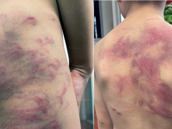 Ảnh bìa bài viết 904632