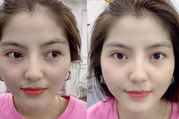 Ảnh bìa bài viết 914438