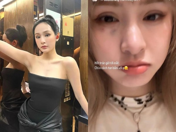 Ảnh bìa bài viết 917841