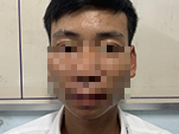 Ảnh bìa bài viết 926456